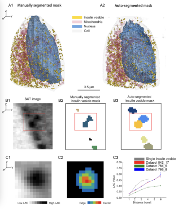 Auto-segmentation and time-dependent systematic analysis of mesoscale cellular structure in beta cells during insulin secretion